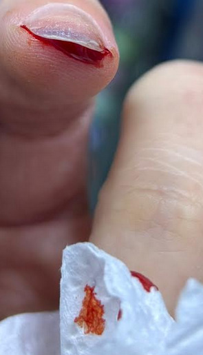 Skärmbild 2026-03-15 062203